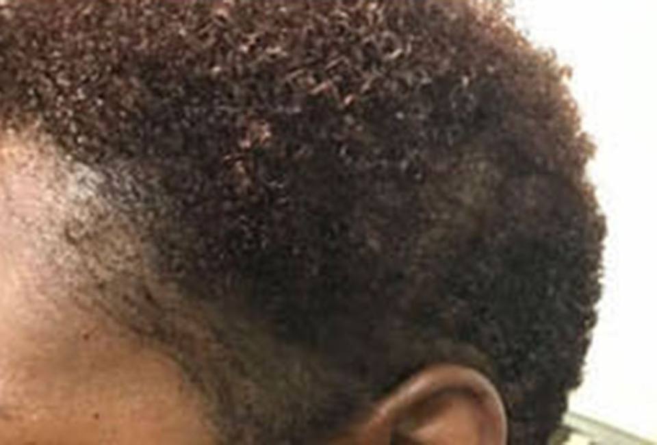 Scalp Micropigmentation & Hair Simulation in Atlanta – The Hair Simulation Company: smp women main