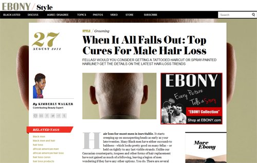 When It All Falls Out: Top Cures For Male Hair Loss|Alopecia Treatment