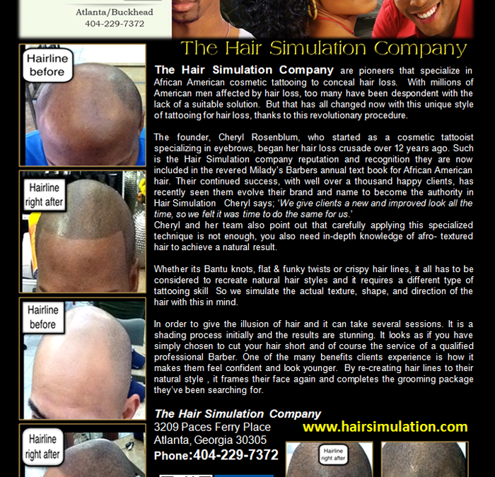 The Hair Simulation Company|Hair Transplant African American