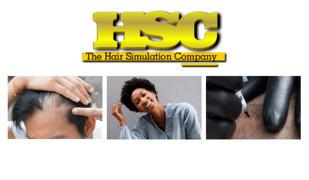 How Hair Simulation Solves Male Pattern Baldness in Atlanta