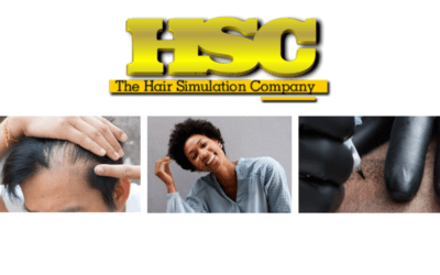 Hair Loss Treatment| SMP Hair Loss Techniques| Interview- Master Barber and Hair Simulation for Hairline #6